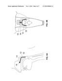 DEVICES AND METHODS FOR TREATING SLEEP DISORDERED BREATHING diagram and image