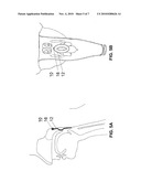 DEVICES AND METHODS FOR TREATING SLEEP DISORDERED BREATHING diagram and image