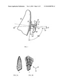 TOOTH MOVEMENT SYSTEM AND METHOD diagram and image