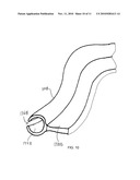 PATIENT POSITIONING DEVICE diagram and image