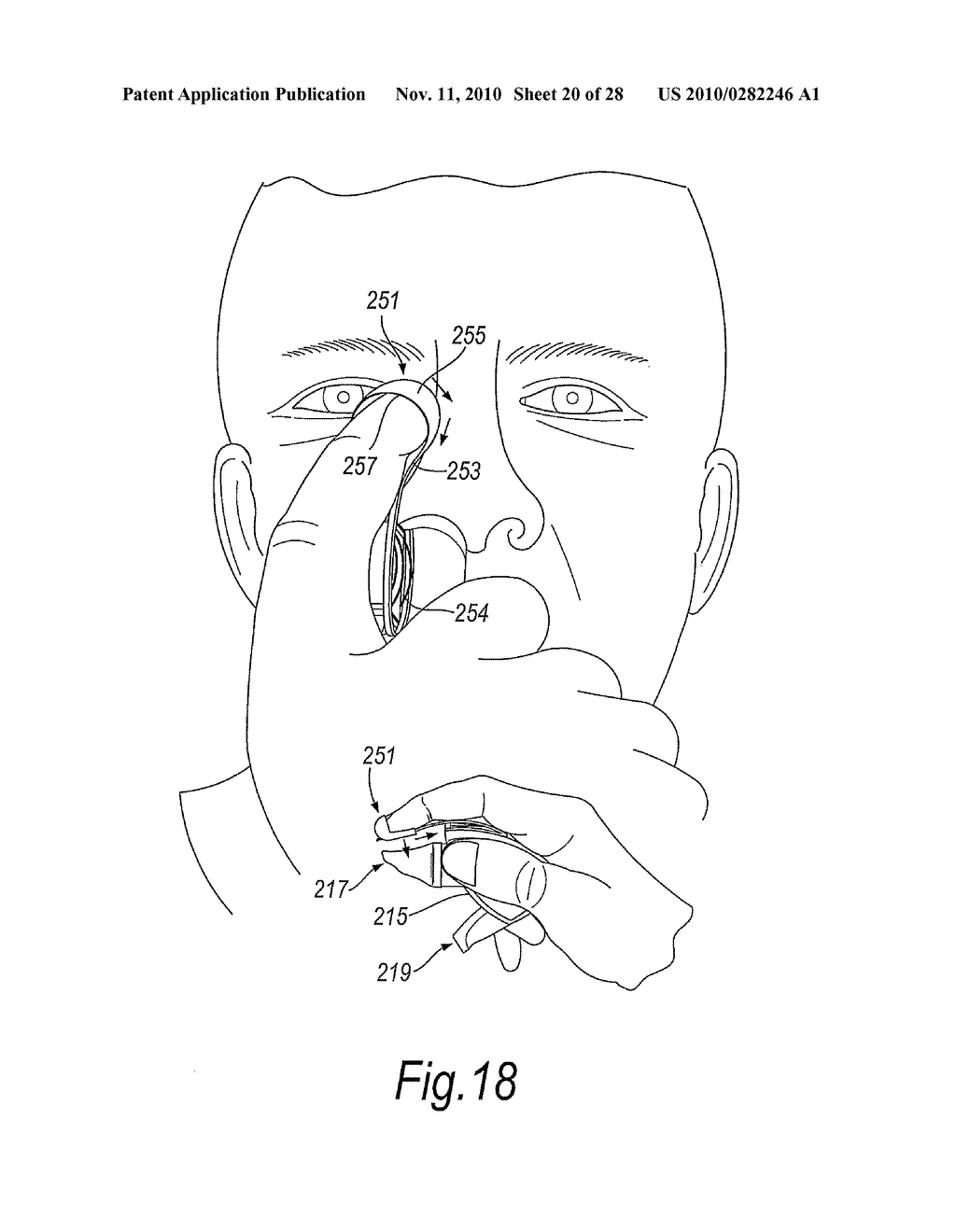 NASAL DELIVERY - diagram, schematic, and image 21