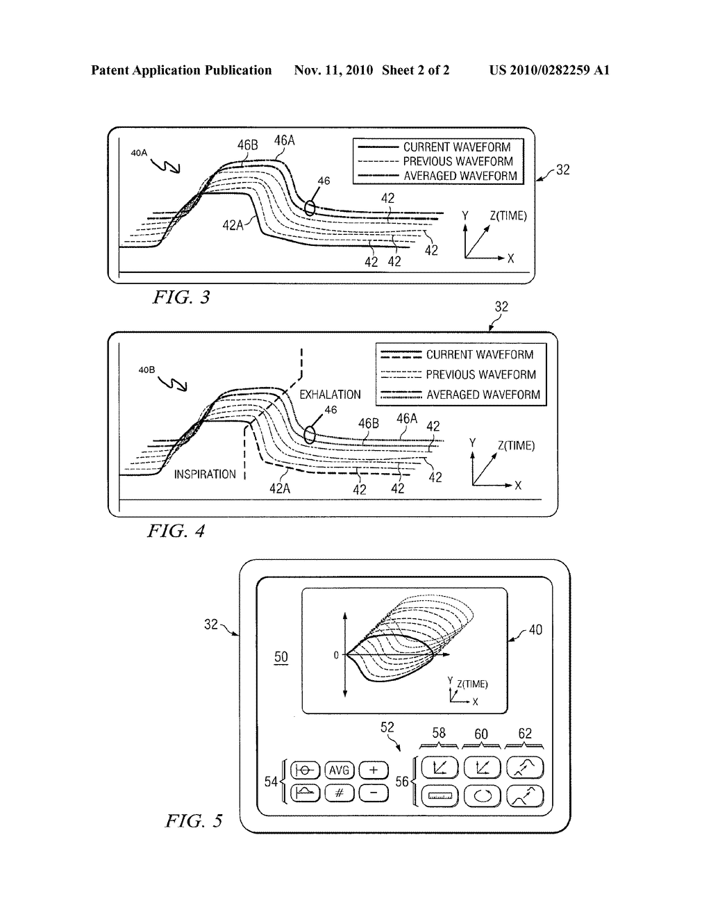 THREE-DIMENSIONAL WAVEFORM DISPLAY FOR A BREATHING ASSISTANCE SYSTEM - diagram, schematic, and image 03