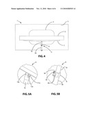 STABILITY SUPPORT TV ANTI-TIP DEVICE diagram and image