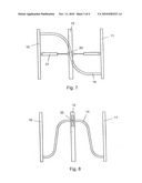 MIDDLE HOOP SYSTEM FOR AN ARTICULATED VEHICLE diagram and image