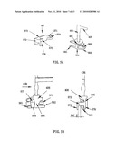 DEVICE AND METHOD FOR DETECTING THE OPENING OF A VESSEL diagram and image