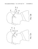 EYEWEAR RETENTION DEVICE diagram and image