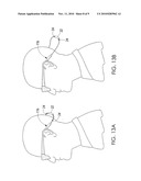 EYEWEAR RETENTION DEVICE diagram and image