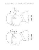 EYEWEAR RETENTION DEVICE diagram and image