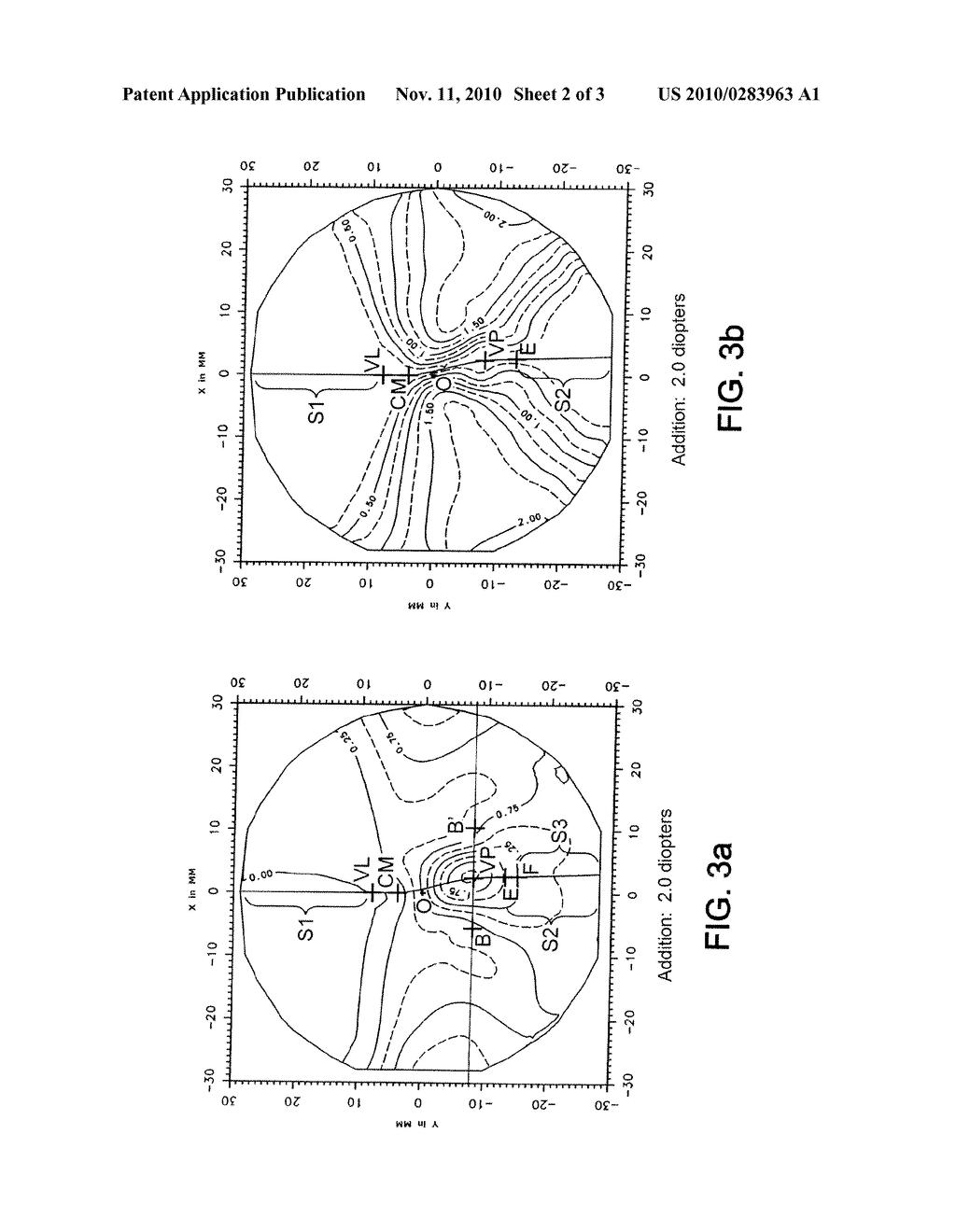 PROGRESSIVE LENS FOR OPHTHALMIC SPECTACLES, HAVING AN ADDITIONAL ZONE FOR INTERMEDIATE VISION - diagram, schematic, and image 03