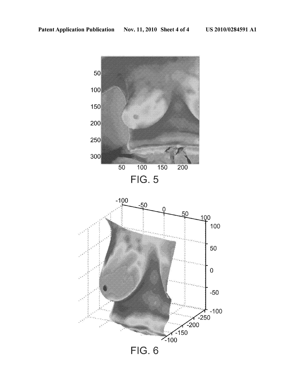 SYSTEM AND METHOD FOR REGISTRATION OF IMAGING DATA - diagram, schematic, and image 05
