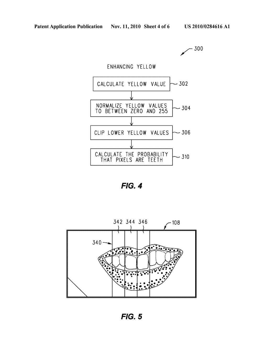 TEETH LOCATING AND WHITENING IN A DIGITAL IMAGE - diagram, schematic, and image 05