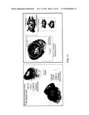 Methods and Agents for Inhibiting Tumor Growth by Targeting the SSDNA Replication Intermediate of Tumor Stem Cells diagram and image