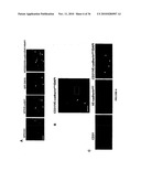 TREATMENT OF TUMORS BY ABLATING BONE MARROW-DERIVED ENDOTHELIAL PROGENITOR CELLS diagram and image