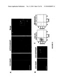 TREATMENT OF TUMORS BY ABLATING BONE MARROW-DERIVED ENDOTHELIAL PROGENITOR CELLS diagram and image