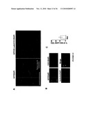 TREATMENT OF TUMORS BY ABLATING BONE MARROW-DERIVED ENDOTHELIAL PROGENITOR CELLS diagram and image