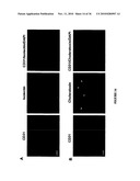 TREATMENT OF TUMORS BY ABLATING BONE MARROW-DERIVED ENDOTHELIAL PROGENITOR CELLS diagram and image