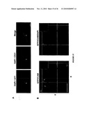 TREATMENT OF TUMORS BY ABLATING BONE MARROW-DERIVED ENDOTHELIAL PROGENITOR CELLS diagram and image