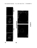 TREATMENT OF TUMORS BY ABLATING BONE MARROW-DERIVED ENDOTHELIAL PROGENITOR CELLS diagram and image