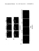 TREATMENT OF TUMORS BY ABLATING BONE MARROW-DERIVED ENDOTHELIAL PROGENITOR CELLS diagram and image