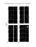 TREATMENT OF TUMORS BY ABLATING BONE MARROW-DERIVED ENDOTHELIAL PROGENITOR CELLS diagram and image