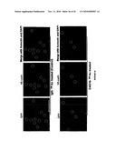 TREATMENT OF TUMORS BY ABLATING BONE MARROW-DERIVED ENDOTHELIAL PROGENITOR CELLS diagram and image