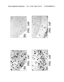 IMMUNOTHERAPY TARGETING OF THE SHARED ABNORMAL CONFORMATIONAL STATE OF AMYLOIDOGENIC PEPTIDES/PROTEINS diagram and image