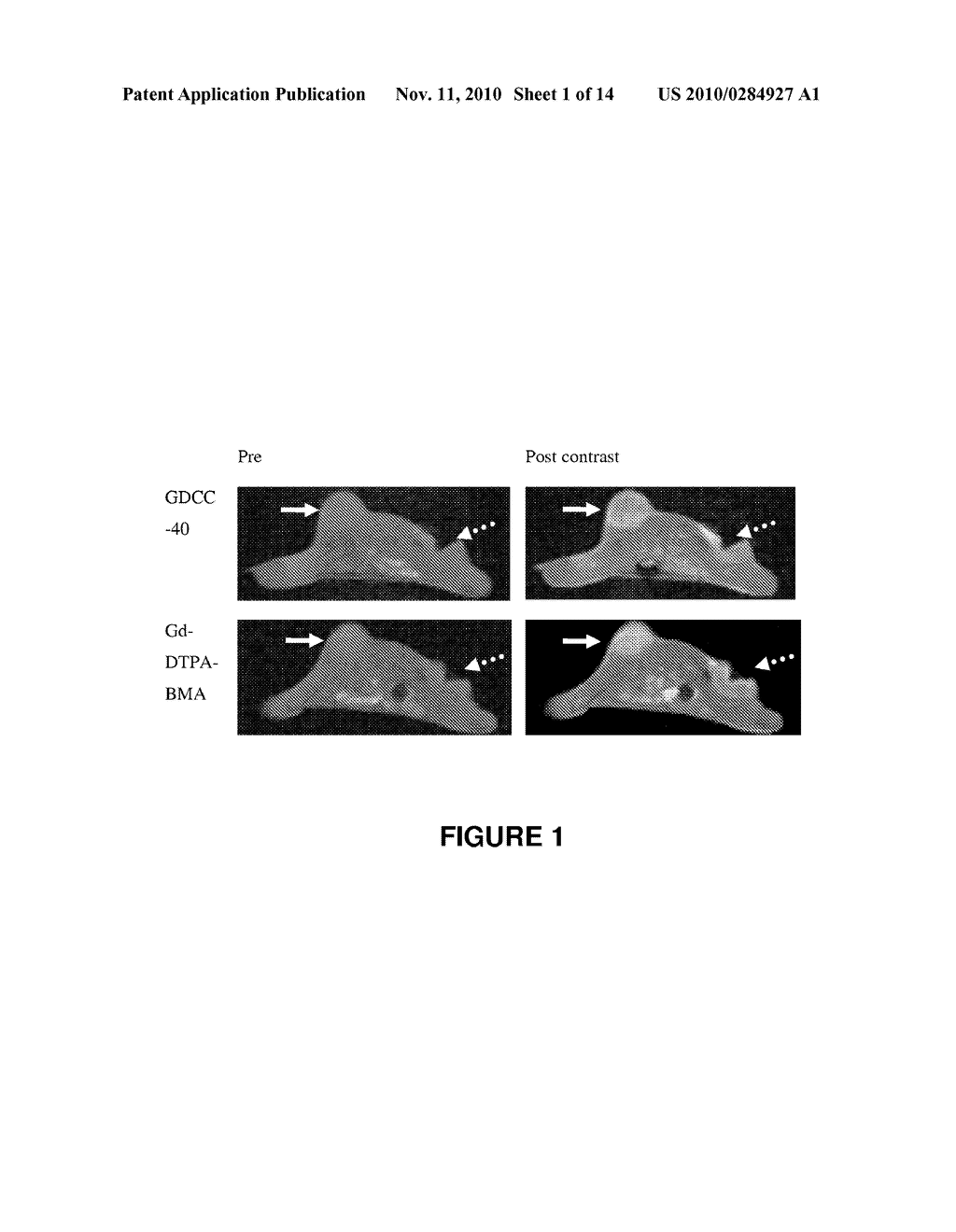 USE OF MRI CONTRAST AGENTS FOR EVALUATING THE TREATMENT OF TUMORS - diagram, schematic, and image 02