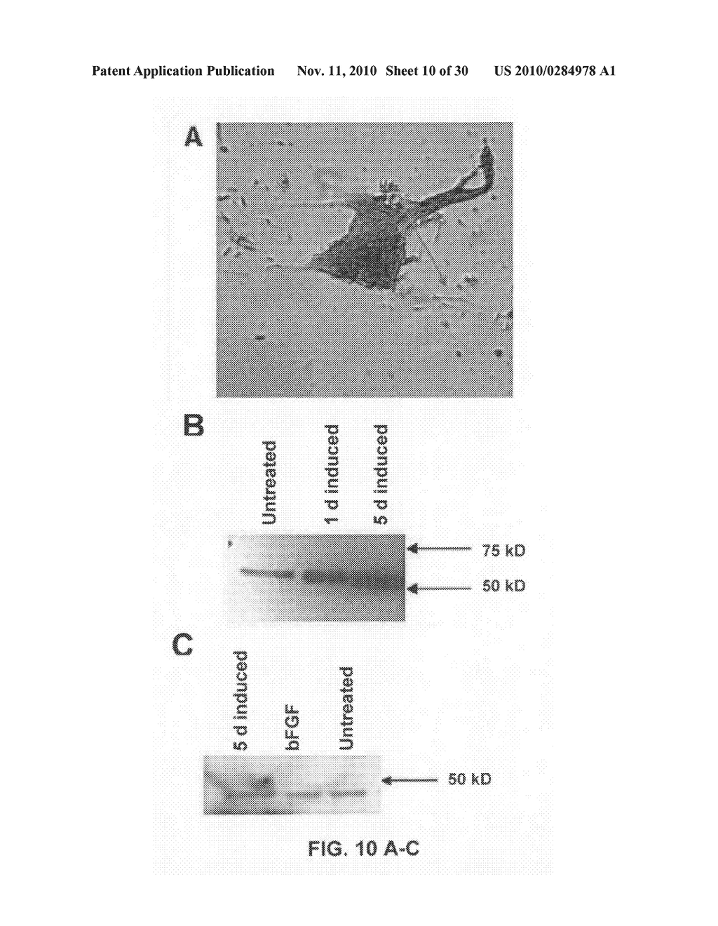 CULTURES, PRODUCTS AND METHODS USING UMBILICAL CORD MATRIX CELLS - diagram, schematic, and image 11