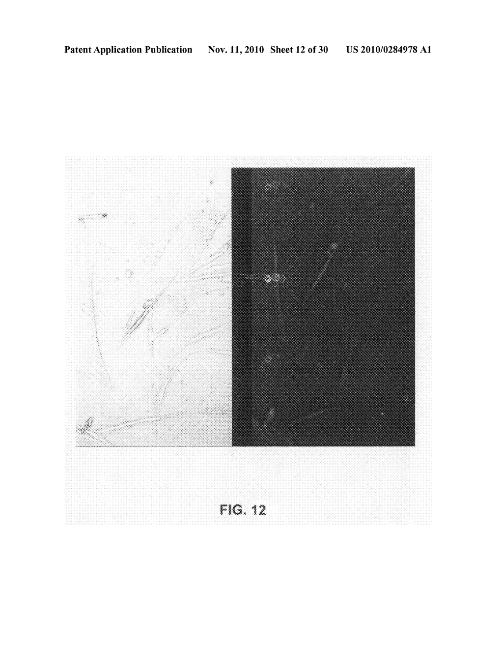 CULTURES, PRODUCTS AND METHODS USING UMBILICAL CORD MATRIX CELLS - diagram, schematic, and image 13