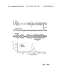 ADENOSINE AND ITS MIMETICS. MODULATORS, TRANSPORT INHIBITORS, AND RECEPTOR AGONISTS AS A THERAPEUTIC TOOL TO REPLACE OR IMPROVE THE EFFICACY OF DEEP BRAIN STIMULATION diagram and image