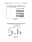 15-PGDH IN COLON CANCER diagram and image