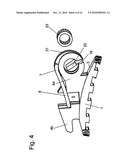 Self-Ligating Orthodontic Bracket diagram and image