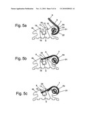 Self-Ligating Orthodontic Bracket diagram and image