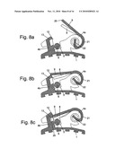 Self-Ligating Orthodontic Bracket diagram and image