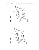 Self-Ligating Orthodontic Bracket diagram and image