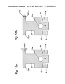 Self-Ligating Orthodontic Bracket diagram and image