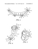 LOW PROFILE ORTHODONTIC BITE CORRECTOR diagram and image