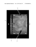 Method And System For Minimally-Invasive Surgery Training diagram and image