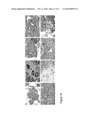 IDENTIFICATION OF ECTOPIC PREGNANCIES diagram and image