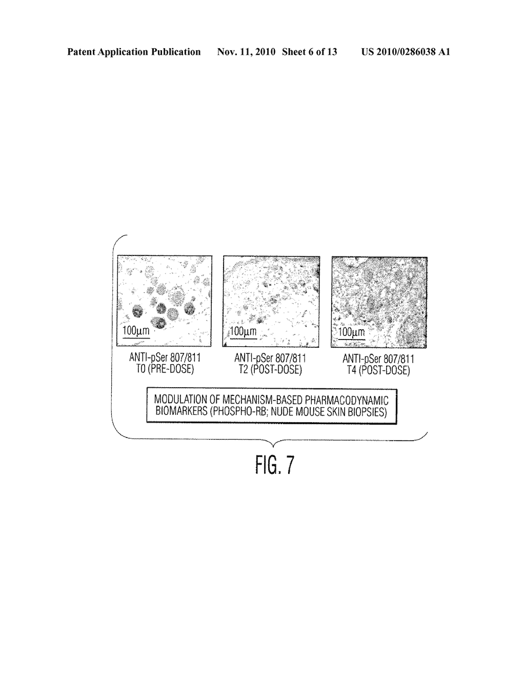 FORMULATION CONTAINING CYCLIN-DEPENDENT KINASE INHIBITING COMPOUND AND METHOD OF TREATING TUMORS USING THE SAME - diagram, schematic, and image 07