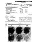 Assessing Chemotherapy Resistance of Colorectal Tumors by Determining Sparc Hypermethylation diagram and image