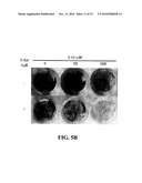 Assessing Chemotherapy Resistance of Colorectal Tumors by Determining Sparc Hypermethylation diagram and image