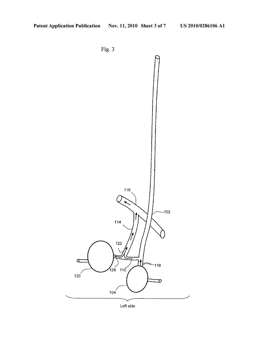 METHODS AND APPARATUS FOR TREATING THE PROSTATE - diagram, schematic, and image 04