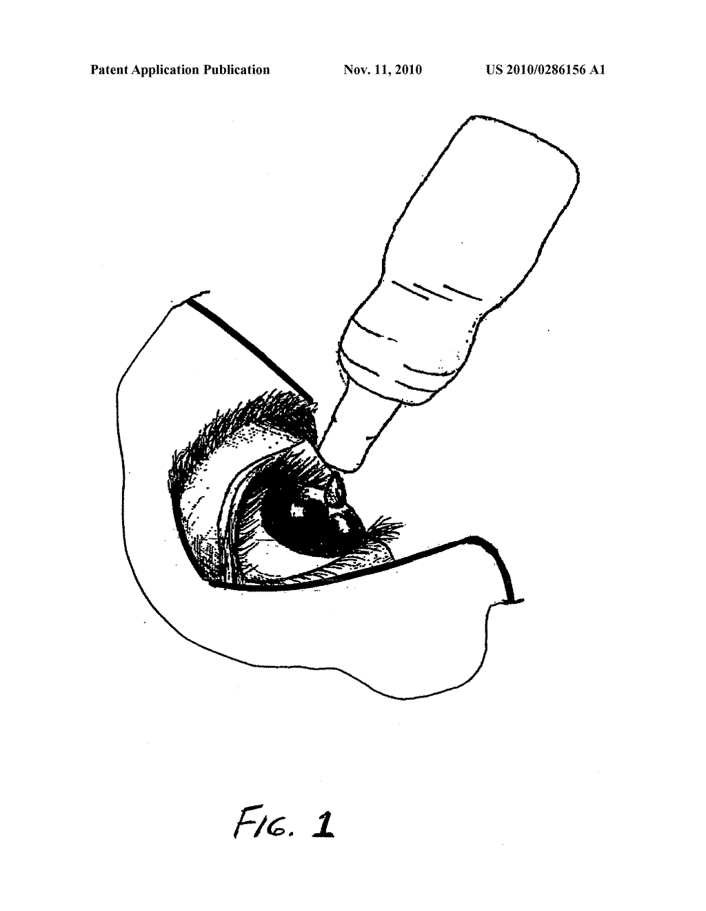 Collyrium For The Treatment Of Conical Cornea With Cross-Linking Trans-Epithelial Technique - diagram, schematic, and image 02