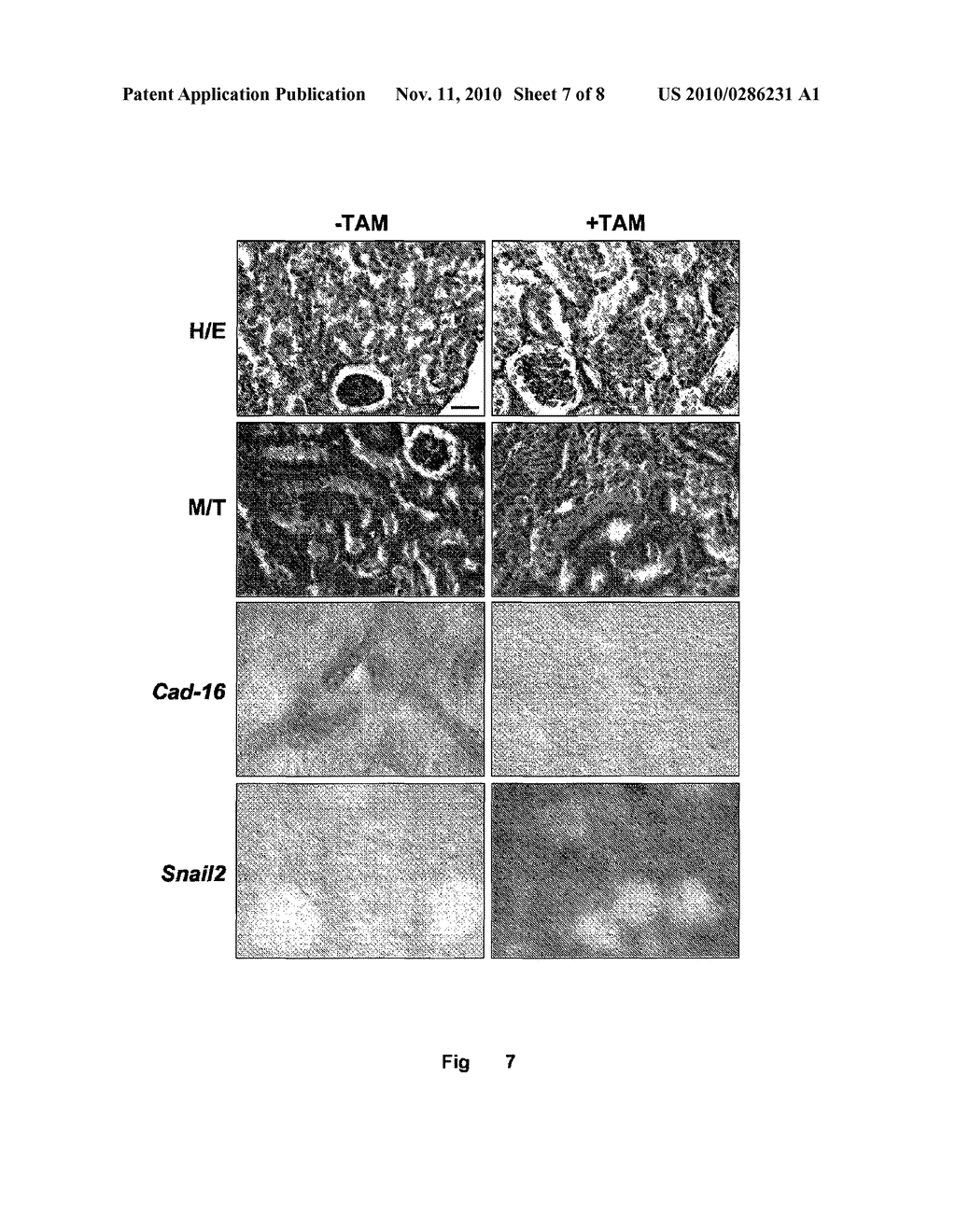 METHOD FOR IDENTIFYING A RENAL FIBROSIS PROCESS USE OF SNAIL- ACTIVITY-INHIBITING COMPOUNDS IN THE PRODUCTION OF PHARMACEUTICAL COMPOSITIONS, METHOD FOR IDENTIFYING SAID INHIBITING COMPOUNDS, SAID PHARMACEUTICAL COMPOSITIONS AND APPLICATIONS THEREOF - diagram, schematic, and image 08