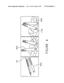 PEDICLE GUIDED RETRACTOR SYSTEM diagram and image