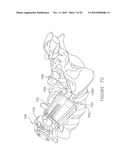 PEDICLE GUIDED RETRACTOR SYSTEM diagram and image