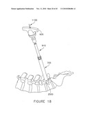 PEDICLE GUIDED RETRACTOR SYSTEM diagram and image