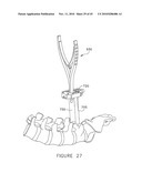 PEDICLE GUIDED RETRACTOR SYSTEM diagram and image