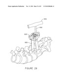 PEDICLE GUIDED RETRACTOR SYSTEM diagram and image